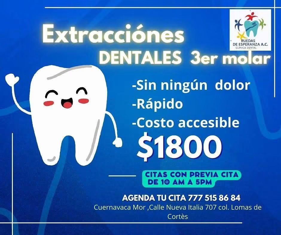 Información de extracciones dentales